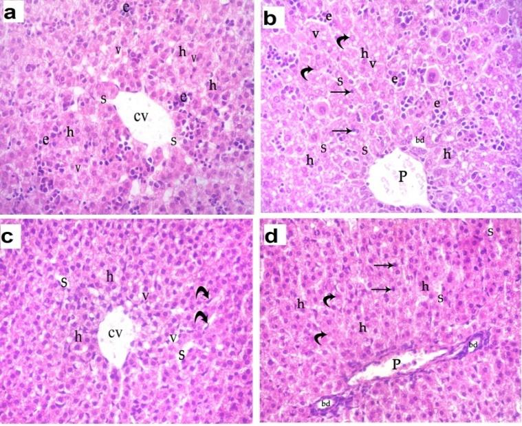 Figure 8: An EM micrograph of a section in the liver of ACR-treated groups: (a) D1ACR showing abnormal hepatocyte with indented nucleus (N) with peripheral condensation of chromatin and discontinuous nuclear envelope (arrow). The cytoplasm contains abnormally swollen mitochondria (m), few rough endoplasmic reticulum (RER), lipid droplets (L), many vacuoles (v) and glycogen granules (g). Bile canaliculus (bc) is dilated. Kupffer cell (k) contains numerous vesicles and lysosomes varying in size and shape in the cytoplasm indicating its activity. (X 10200); (b) D21ACR showing abnormal hepatocyte with shrunken (N) and peripheral condensation of chromatin (arrow). The cytoplasm contains abnormal shaped elongated mitochondria(m), rough endoplasmic reticulum (RER), some lipid droplets (L), rarefication of the cytoplasm (*) appeared as electron lucent areas. Bilecanaliculus (bc) contains few microvilli. Notice Kupffer cell (K). (X 8500). **3-Acrylamide Plus Vitamin E-Treated Group** **Hematoxylin and eosin staining:** LM examination of sections from the liver of D1ACRVE albino rat showed normal central vein, blood sinusoids, portal vein and bile duct. Most hepatocytes were normal with polygonal large vesicular nuclei and acidophilic cytoplasm. Few hepatocytes had dark stained nuclei and others had pale nuclei. Few vacuoles were present in the cytoplasm of some hepatocytes. Multiple erythroid islands with intense hyperchromatic nuclei were present**.** Liver section of D21ACRVE subgroup showed apparently protection when compared to D21ACR. Hepatic architecture appeared similar to normal. Most of hepatocytes were normal with polygonal large vesicular nuclei and acidophilic cytoplasm however some hepatocytes had dark stained nuclei and others had pale nuclei. Few vacuoles were present in the cytoplasm of some hepatocytes. Normal central vein, blood sinusoids, portal vein and bile duct were observed (Figure 9).