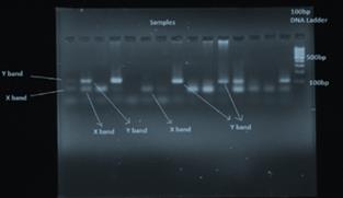 Figure 2: Electrophoresis in gel of amelogenin gene amplified.