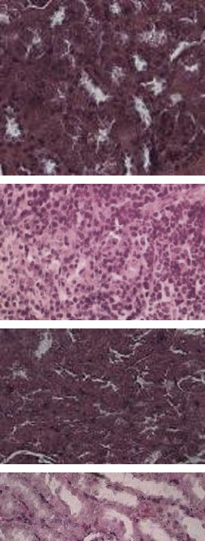 Figure 2: Histopathological performance of kidney in the normal rat (a), Metforminhydrochloride (b), diabetic rat + Dichloromethane extract with dose in 100mg kg−1 b.wt. (c), diabetic rat + Barringtonia extract with a dose of 500 mg/kg/bwt. (d). Pink arrow: Proximal convoluted tubule, Blue arrow: Glomerulus.