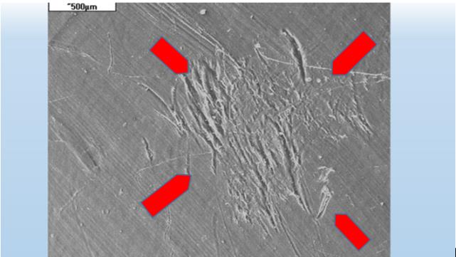 Figure 11: Oxalates (blue arrows) among carbonates (green arrows), crystallized on the socket surface of hip joint endoprosthesis. SEM.