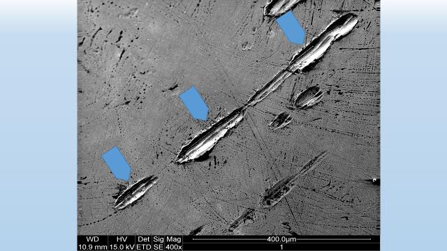 Figure 18: Microslag and a hole remaining after a microslag was torn out in fine-crystalline steel of chromium-nickel head of the endoprosthesis.
