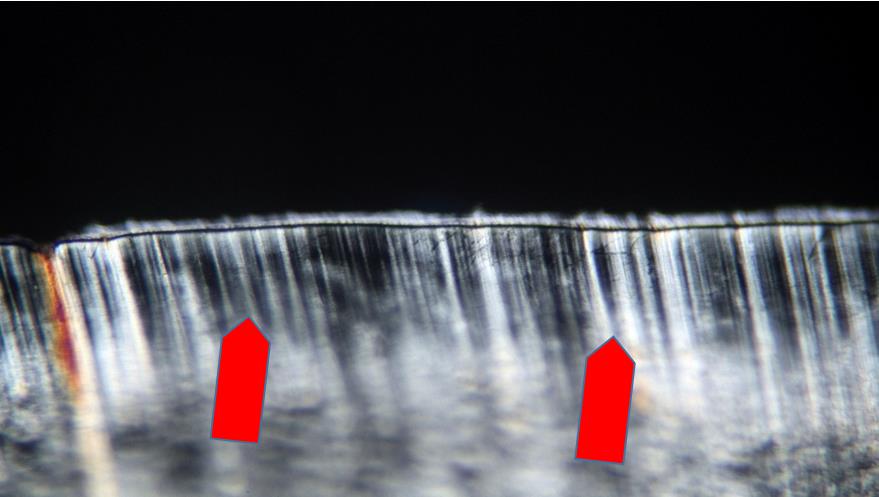 Figure 6: Image of the inside of acetabulum socket affected by structural changes due to the aging of polymer. Visible cracks of 1-2 µm width SEM.