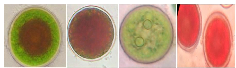 Figure 2: Light microscopic images of H. pluvialis cells.