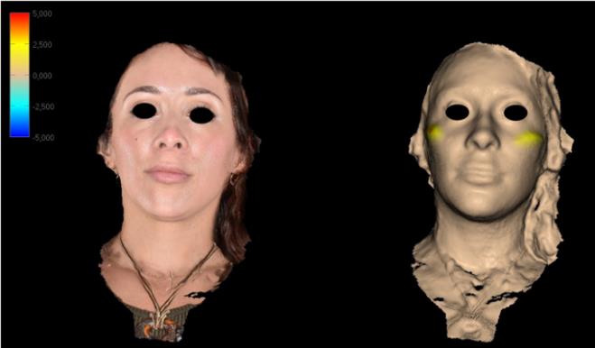 Figure 5: Life Viz Software Volumetric Color Rendering.