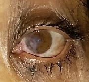 Figure 3: Postoperative photograph of the patient.