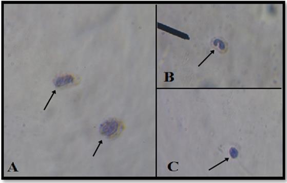 Figure 7: Differential WBC of _O. niloticus._ (A) Neutrophils, (B) Monocyte and (C) Lymphocyte.