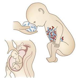 Figure 1: Inoculum' of Vaginal Bacteria for Cesarean Mode of Delivery. Thinking of the idea of partial restoration of the microbiota of CS-infants could be done when the vaginal- anal microbial content is introduced to the CS delivered infant directly after birth. The vaginal content is very limited and low in Lactobacillus spp. and does not contain the microbes of the gut of the mother but both can help especially when the mother is on probiotics before delivery. If the mother is on probiotics during pregnancy and feeds the infant directly by breast milk then this will help formulate the microbial flora of the infant [6]. Collecting birth-canal bacteria and wiping them onto babies after birth could help babies delivered by CS to restore some of the vaginal bacteria which they missed [7]. This is done by using gauze to gather a mother's birth- canal bacteria and apply on the face of babies born by CS thus making the bacterial populations to partially resemble those of vaginally born babies. This intervention is simple but needs to gain medical approval [8]. During labor, the baby is passing the birth canal and in tight contact with the mucosa of the birth canal for a long time so bacteria start to establish in the mouth and gut while growing and colonizing before the baby is delivered. This gauze technique for CS infants would seem to be a simple intervention. Nevertheless, we have to be cautious as with any vaginal delivery to make sure that the mother is HIV-negative, strep-B negative, and has an acid lactobacillus-dominated vagina [8].