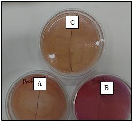 Figure 10: TSIA. (A) Isolate D1, no fermentation; (B) Uninoculated; (C) P. aeruginosa, no fermentation but with H2S production; (D) P. vulgaris, with glucose and lactose or sucrose fermentation and H2S production; (E) E. coli, with glucose and lactose or sucrose fermentation with acid accumulation.