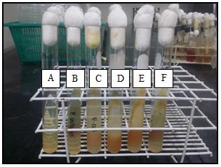 Figure 15: Urea hydrolysis. (A) Uninoculated tube; (B) P. vulgaris, positive result as indicated by the formation of red color; (C) E. coli, negative result; (D) Isolate A4, negative result; (E) Isolate A5, negative result; (F) Isolate A6, positive result.