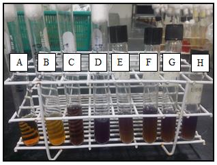 Figure 16: Phenylalanine deamination test. (A) Uninoculated tube; (B) P. vulgaris, positive result as indicated by the appearance of green color; (C) E. coli, negative result; (D) Isolate A4, negative result; (E) Isolate A5, negative result; (E) Isolate A6, positive result.