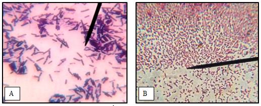 Figure 5: Gram staining. (A) Bacillus polymyxa, gram positive bacterium; (B) Isolate A5, gram negative bacterium.