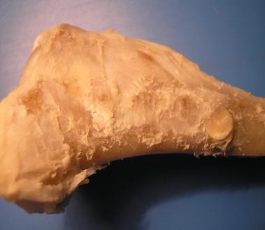 Figure 6: Using of biocomposites in oral and maxillo-facial surgery.