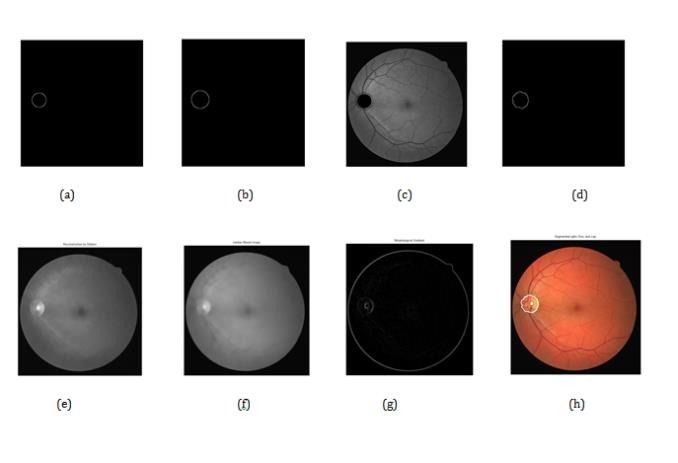 Figure 5: Optic disc (OD) and Optic cup (OC) segmentation: (a) internal marker for OD segmentation as circle considering OD center obtained using CHT in previous step as center and radius as 0.92* Q (Q as radius obtained using CHT), (b) external marker for OD segmentation as circle considering CHT processed center and radius as 1.2*Q, (c) marker controlled watershed transformed image which superimposes internal and external markers on gradient (sobel operated gradient) of original image, (d)OD boundary (watershed line), (e) Reconstructed image (reconstruction by dilation) for OC segmentation, (f) median filtered image, (g) morphological gradient of median filtered image, and (h) final segmented result of OD and OC (OC segmentation using marker controlled watershed transformation).