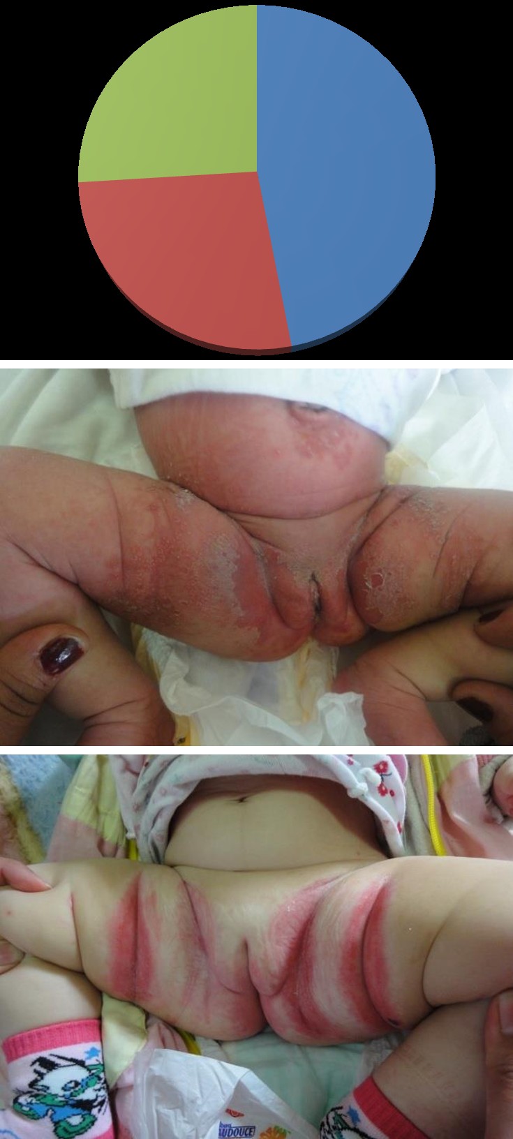 Figure 2: Categories of diaper rash.
