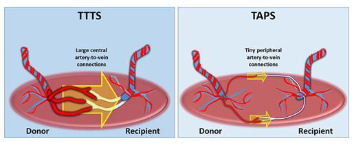 Figure 13: A schematic of single sperm twins containing common genes (left) versus twin sperms that contain half of the common genes (right).