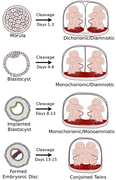 Figure 8: Schematic view of the penetration and fusion stages of twin embryos with TTT syndrome.