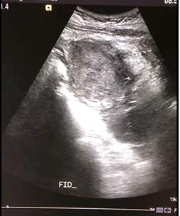 Figure 1: Pelvic Ultrasound.