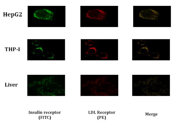 Figure 1: **Western blots:** Universality of association of the two receptors in cell organelles e.g. in endoplasmic reticulum (ER), golgi apparatus and plasma membrane has been explored by immuno-precipitating LDLR from different tissue cells viz. goat liver and term placenta, and by performing western blot of IR from the immune- precipitate of LDLR (Figure 2). The presence of IR band in the immune-precipitate of LDLR marks a strong evidence of association and adherence of these two receptor proteins in the post translational steps through endoplasmic reticulum and golgi body to plasma membrane. Proof of evidence of association of the receptors within the caveolae of plasma membrane has been revealed by observing LDLR band in the western blot from the immune-precipitate of IR which has been immune-precipitated from caveolae protein (caveolin). The caveolin protein was immune-precipitated by anti- caveolin antibodies (CV1, CV2 and CV3) from plasma membrane fraction isolated from HepG2 cells (Figure 3). It is noteworthy to mention that insulin receptor was originally found within the caveolae of the surface membrane [4,5].