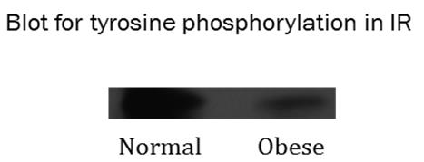 Figure 4: The western blot with anti-tyrosine- phosphate antibody shows a decrease in the band density of IR-tyrosine-phosphate in the peripheral blood mononuclear cells (PBMC) of obese subject. Similar results were also found in other blood borne cells too (not shown) with the progress of obesity. This could be the reason of lateral inactivation of IR and LDLR in IR-LDLR complex.