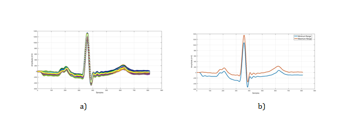 Figure 10: Normalization phase for (anterior-V5), the approach based on two types of “frequencies” calculation: