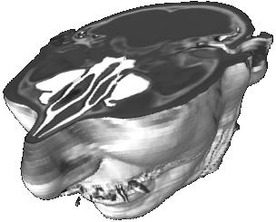 Figure 13: CT brain slice and map invasive. (a) Original image representation. (b) Graphical representation each anatomical structure through the track, as well as the value of the risk of the surgical access [20].