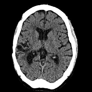 Figure 18