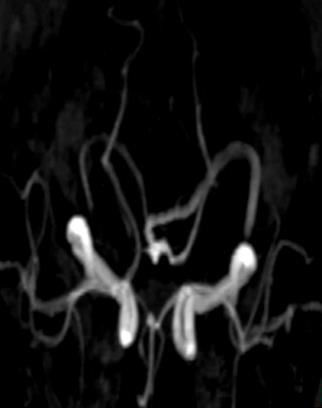 Figure 9: Original CT image and its corresponding content.