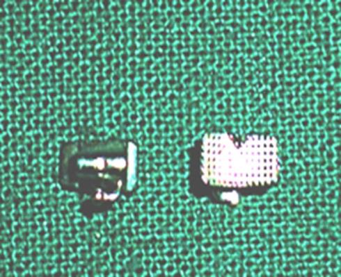 Figure 1: 0.018” Preadjusted Edgewise Roth Molar Tubes