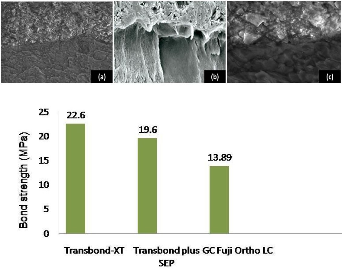 Figure 17: Group-C (G.C. Fuji Ortho LC) 17a: Enamel adhesive interface showing no cracks in the enamel at 1500X; 17b: Enamel adhesive interface showing absence of micro tags 3000X; 17c: Enamel adhesive interface showing large filler particles of the glass ionomer under high magnification at 6000X.