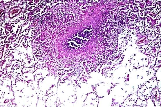 Figure 14