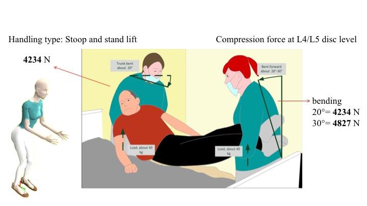 Figure 1: Compression forces on L4 / L5 calculated with 3DSSPP during transfer of a patient with extreme stretched pains.