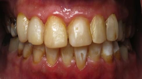 Figure 1: Initial case frontal view.