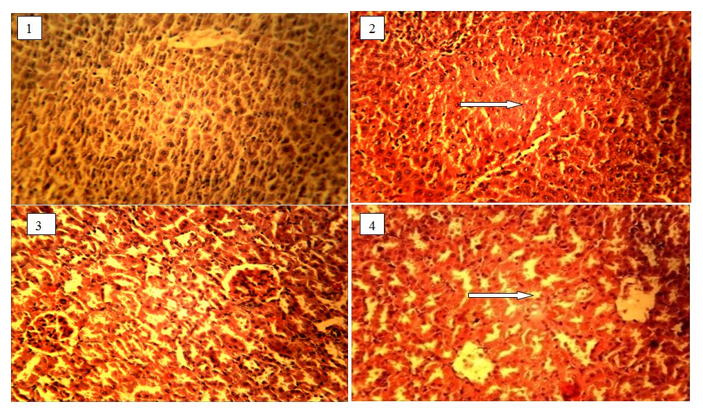 Figure 1: Histology of the liver of rats (1&2) showing the control and the one administered with (0.56mg/kg) extracts of S. longepeduncuata.