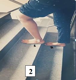 Figure 4: Knee joint position during stair climbing (Step over step pattern). Tester: If safety is concerned the tester should guard behind\below the participants going up the stairs. If there is no concern for safety, then the tester should remain on the start\finish position on the ground landing. The difference was considered statistically significant at a p value of <0.05.