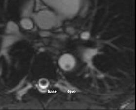 Figure 3: Illustration shows patch repair.
