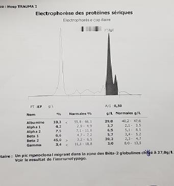Figure 4: Serum protein electrophoresis: narrow peak migrating in the gamma globulin zone.