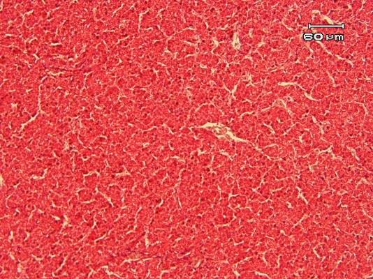 Figure 1: Up left: normal structure of liver; other pictures show the harmful effects of cadmium on the shape of hepatocytes and obvious hemorrhage (H&E).