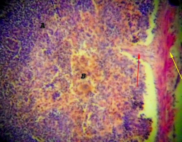 Figure 3: Photomicrograph of Camel Spleen showing clearly differentiated zones of white pulp (A) and Red pulp (B) cells with communication of paranchymal traberculae connective tissue fibers connective tissue (Red arrow) and thick connective tissue fibers capsule (Yellow arrow) H&E x200.