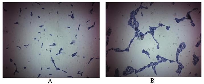 Figure 3: Cell Morphology of Candida Guillermondi BDU- 217 after Simultaneous Direct and Inverse Bioresonance Effects: Small Colony Cells (A) and Large Colony Cells (B).