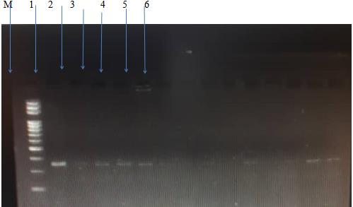 Figure 1: HBVDNA PCR result (350bp) on 2% agarose gel. Lane 1 show positive control, lanes 2,3,4 and 5 show positive results in four patients lane 6 show negative control, M: 100bp DNA Marker.