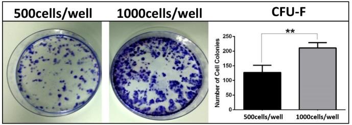 Figure 5: CFU-F Assay. Macroscopic view and CFU-F counts of colonies at the end of 14 days at 500 cells/well and 1000 cells/well cultured group.