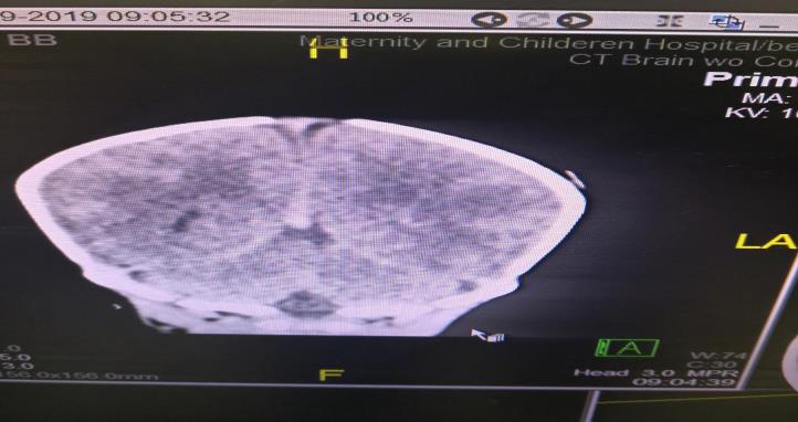 Figure 1: Clinical Presentation in Relation to Imaging Findings.