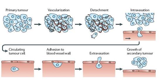 Figure 1: Cellular process in Metastasis.