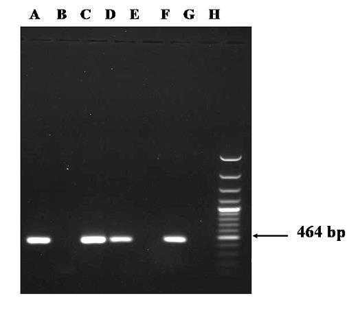 Figure 2: PCR amplified product of ~460 bp length of ASA.S1 region of 18S rRNA gene of Acanthamoeba spp. obtained from corneal scrapings of suspected amoebic keratitis patients.