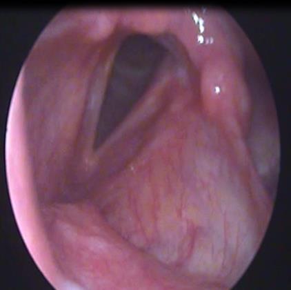 Figure 4: Postoperative image-the next day.