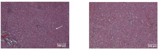 Figure 10: H&E, X100