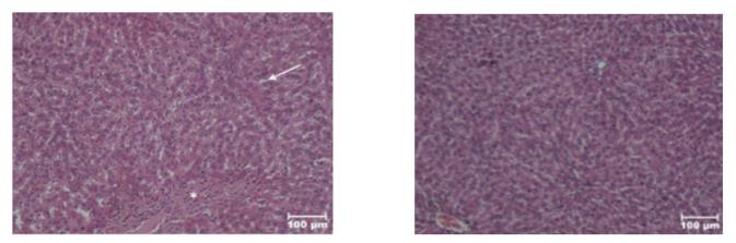 Figure 6: H&E, X100.