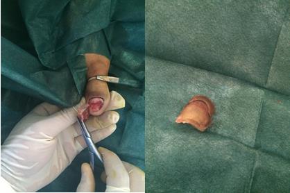 Figure 3: 48h after surgery.