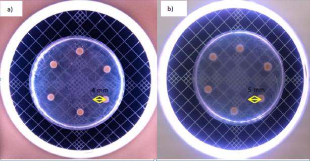 Figure 2: a) Laurel Seed Oil; at the end of the 24-hour incubation period, b) Laurel Seed Oil; at the end of the 48-hour incubation period.