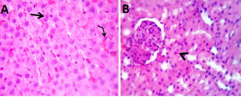 Figure 3: Photomicrograph of liver (A) showing apparently normal hepatic parenchyma with double nuclei of hepatocytes (arrow) and focal dilatation of some hepatic sinusoids (curved arrow). (B): Kidney showing apparently normal nephron units and stroma with a few degenerative changes in some renal tubules (arrow head). H&E X 400